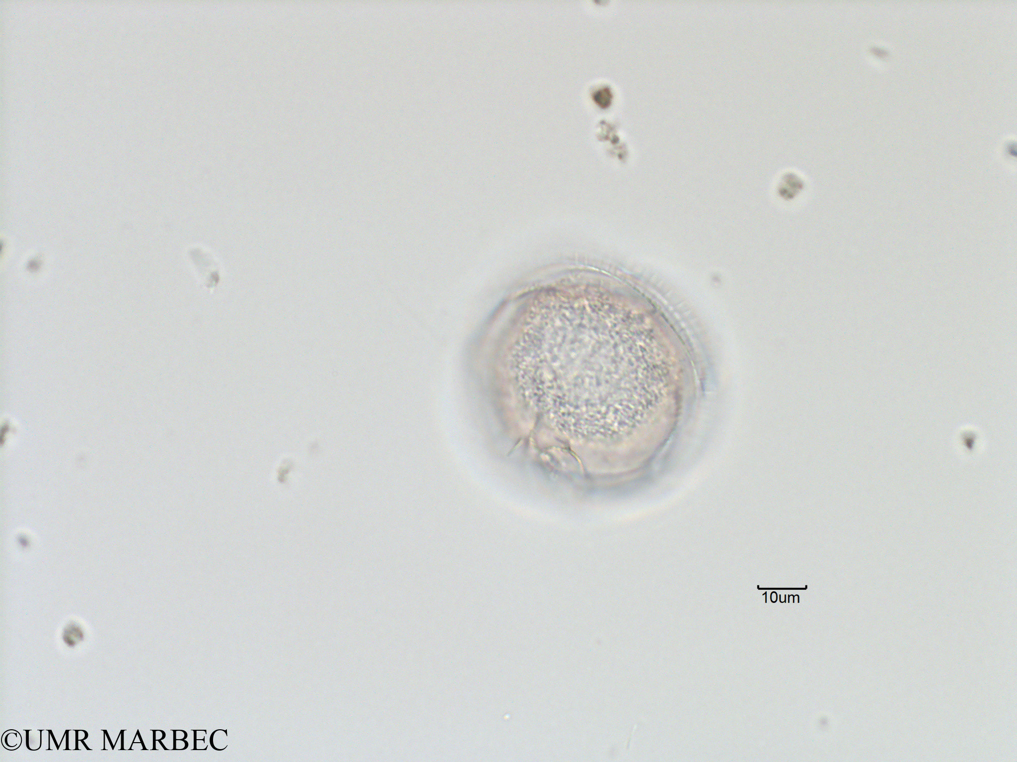 phyto/Bizerte/bizerte_bay/RISCO November 2015/Protoperidinium sp46 (Baie_T5-C3-dino avzc suture-3).tif(copy).jpg
